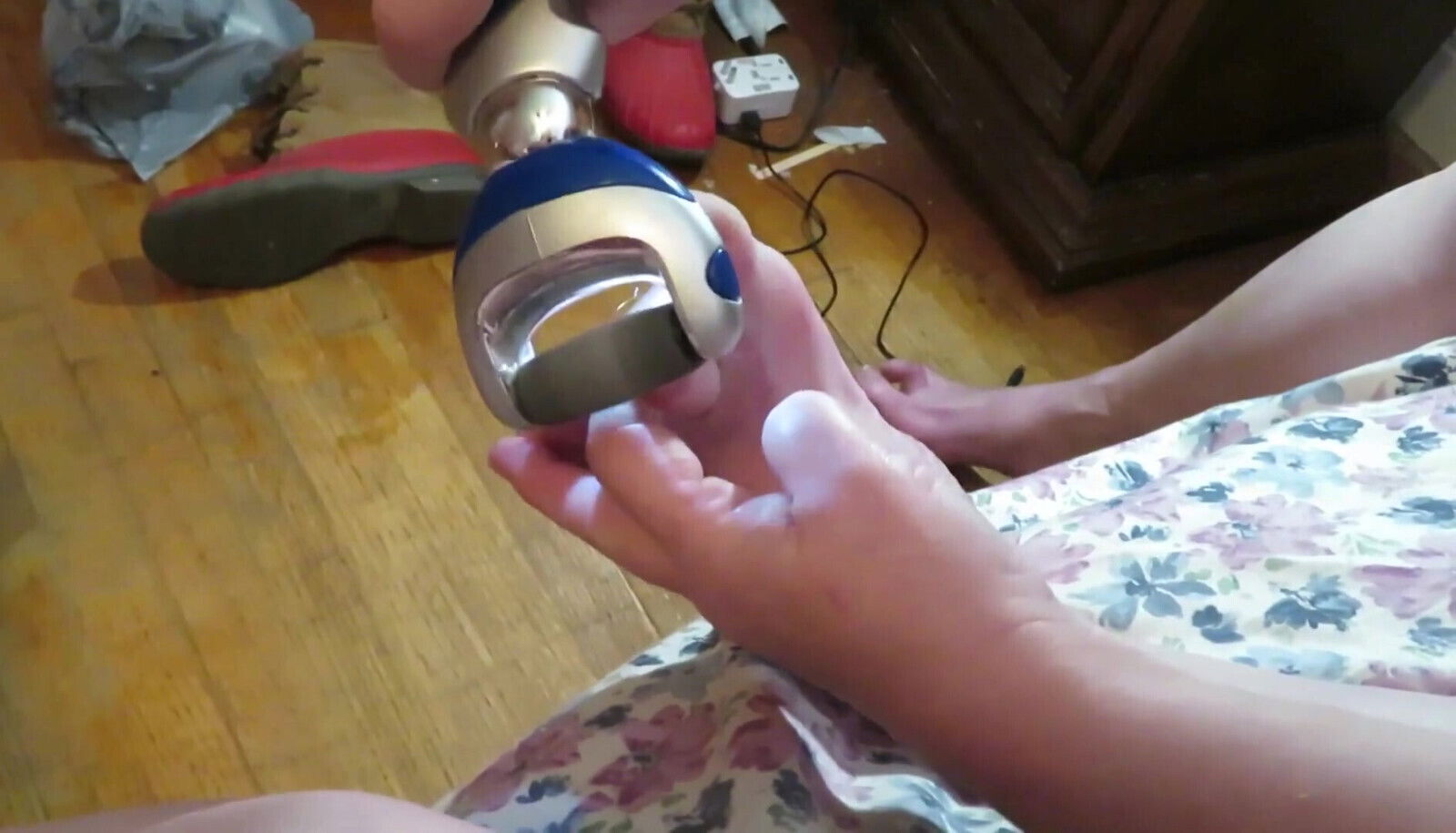 Nurse Vicki grinds nails down with electric Pedi tool Poor ugly toes need real bad!