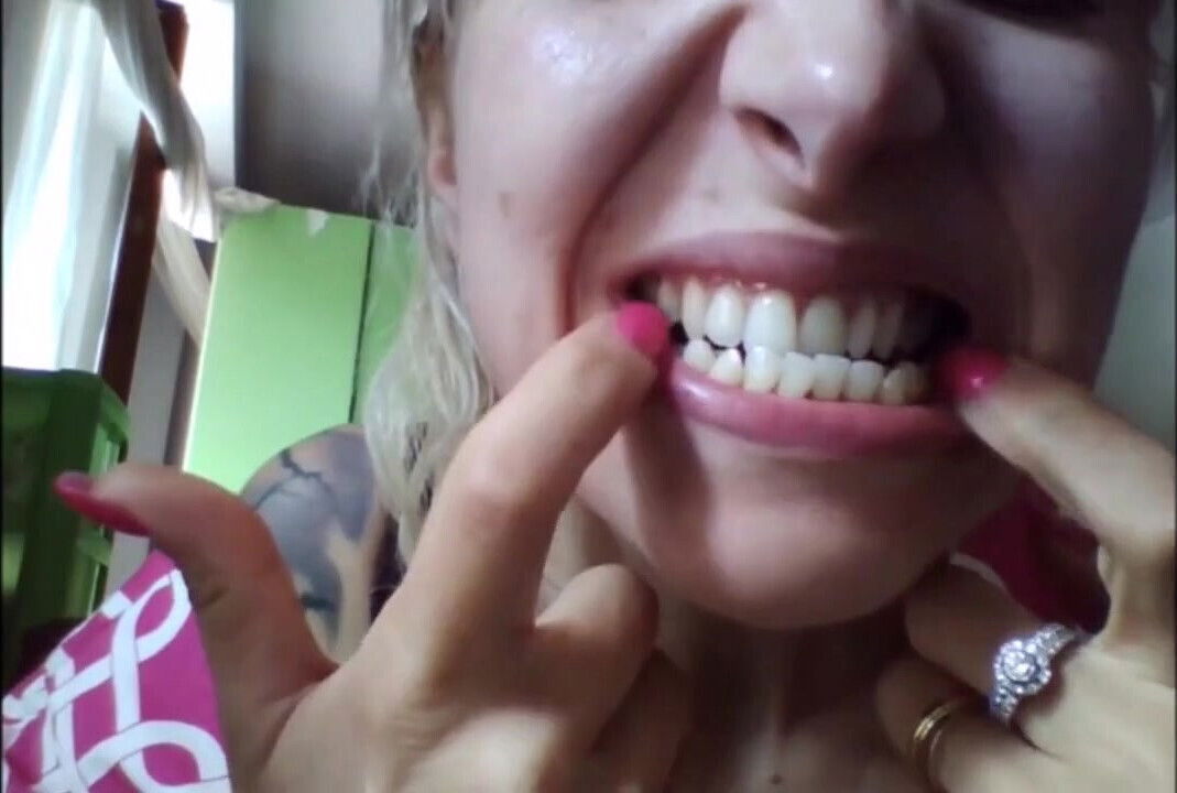 Beautiful Face, but Rotten Teeth!