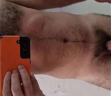 Peludo queimado de sol depois de um dia de praia