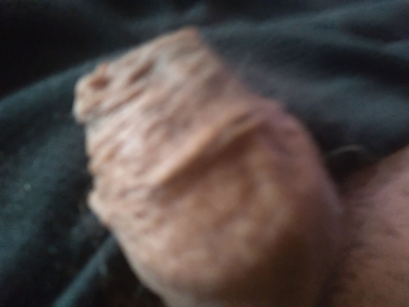 man penis wrinkled foreskin