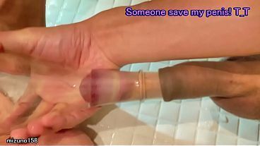 My penis got sucked into the bottle and won'_t pull out!(by negative pressure)