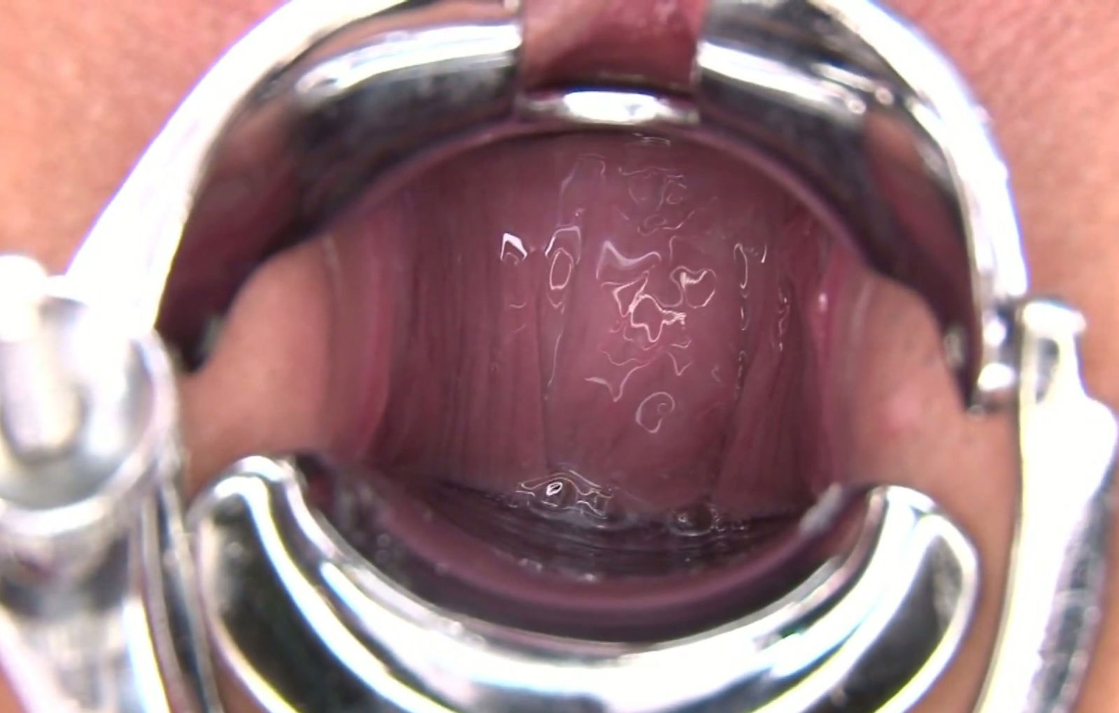 Bondage chick Hikaru Momose fucked with vaginal speculum