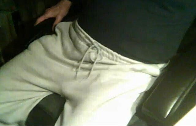 77 yo man from Slovenia - 3