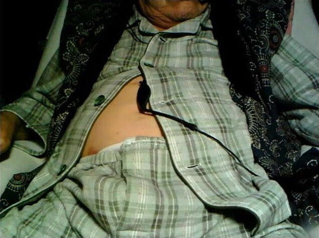 80 yo man from Japan - 4