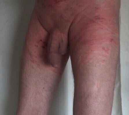 Self hard Punishment