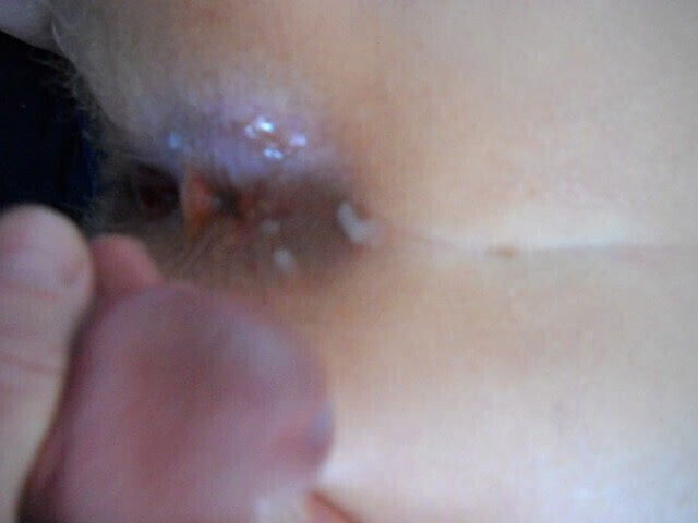 wife's spread asshole