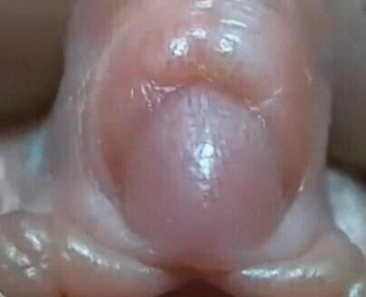 Mature clit close-up