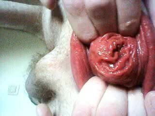 Playing with my meaty prolapse