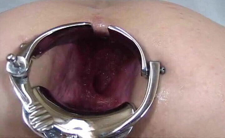 Elmer's Wife fisting speculum