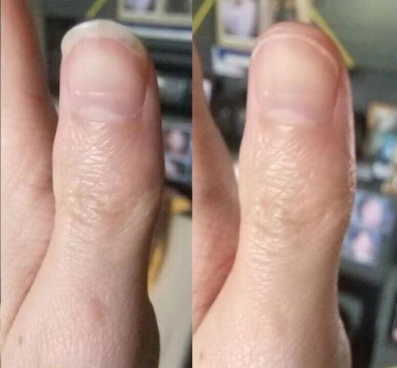 Olivier hands nails fetish pictures from 2013