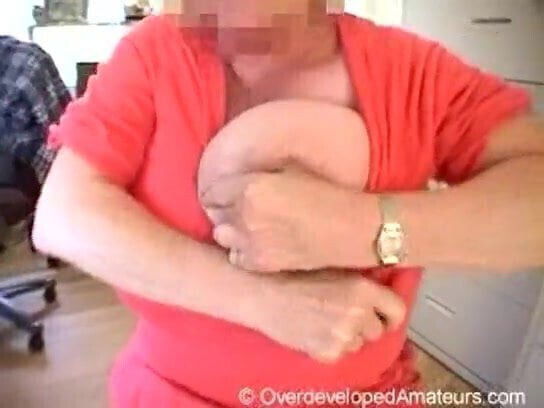 Over-developed broad