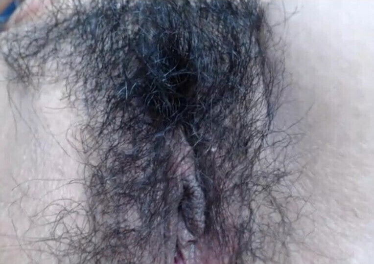 Hairy Mexican with braces