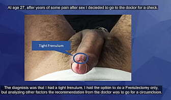Circumcision?? Check this out.