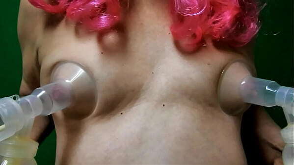 Cdcumdump milking with electric breast