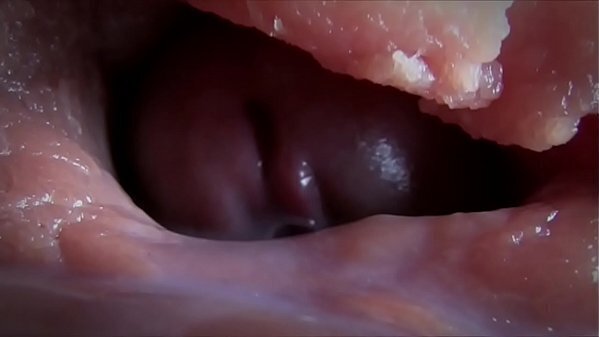 compilacao esporradelas