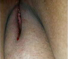 Tirando sangue do cu da gordinha feminaze