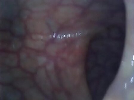 Lucy takes endoscope