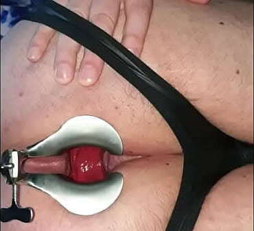 Speculum play