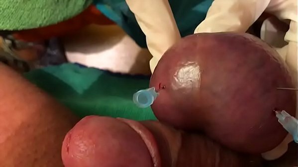 first ball needles-ADelta