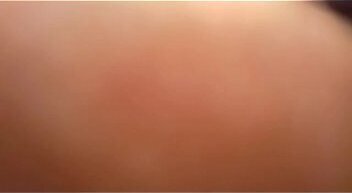 toc&aacute_ndose para