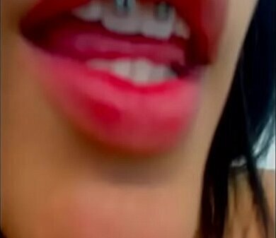 home another beautiful braces girl