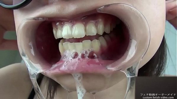 woman shows gums sputs saliva