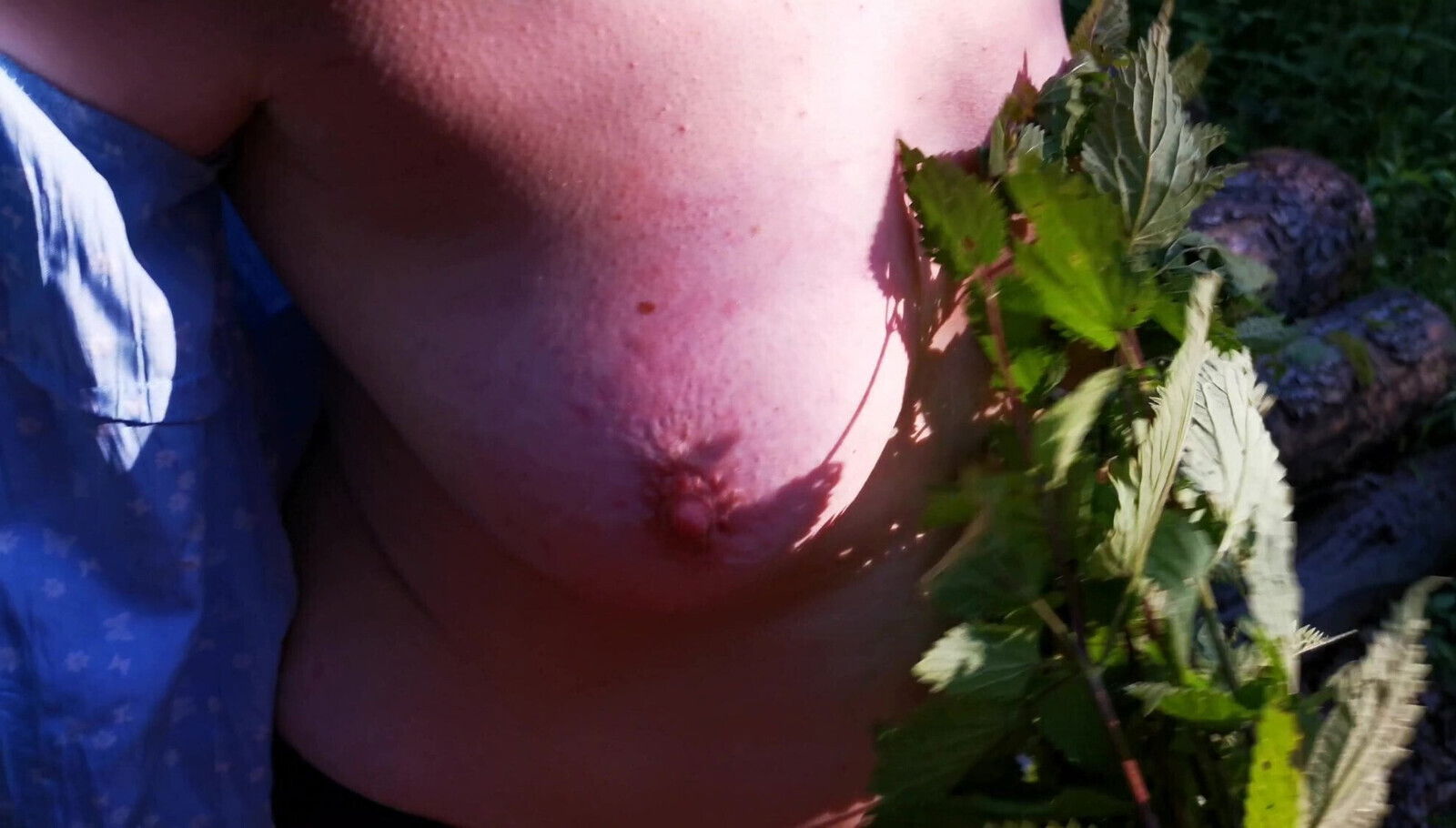 nettles, extreme public