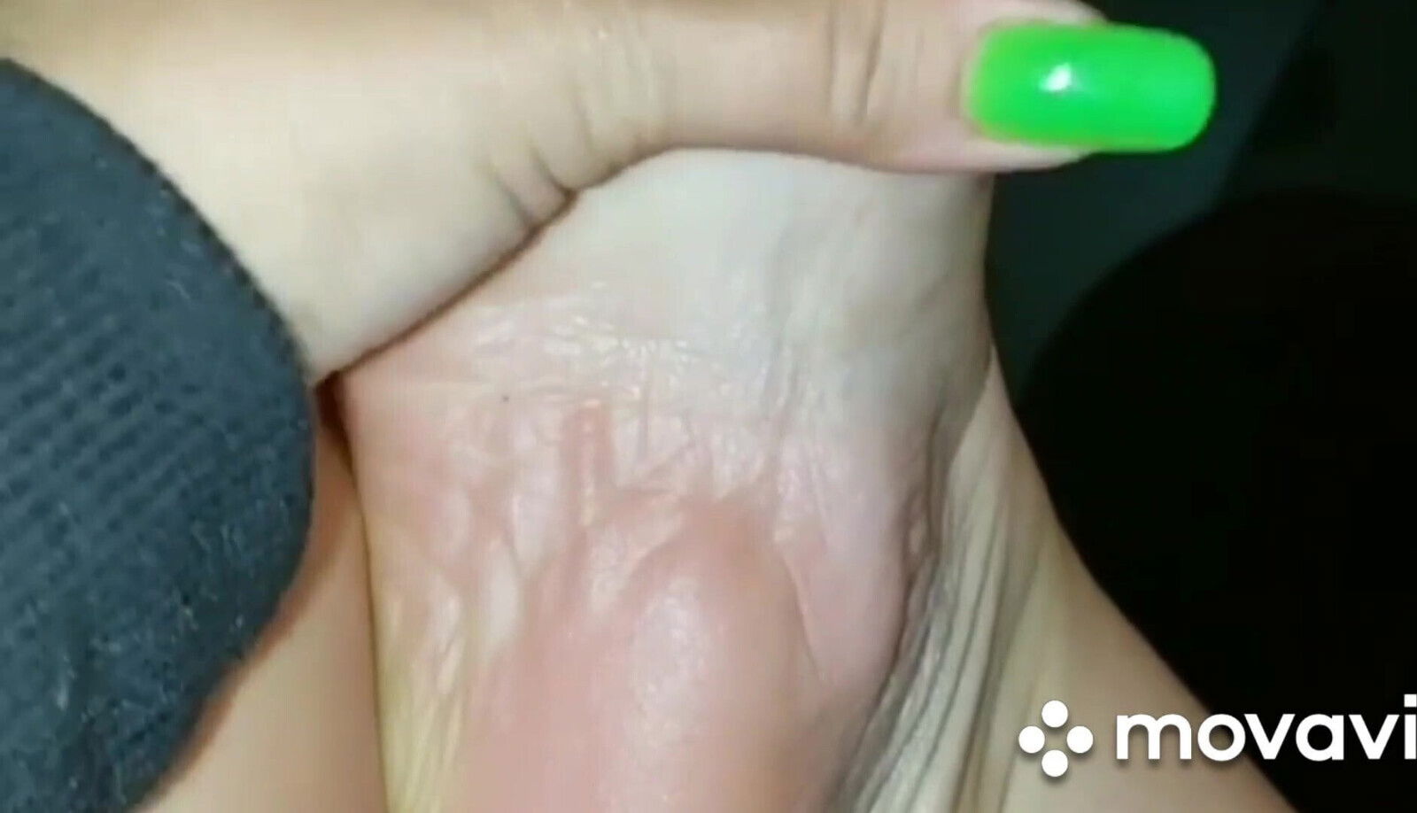 (Karaspiggies) Mighty Wrinkles