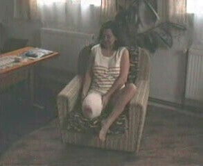 Zdenke Amputee Pretender