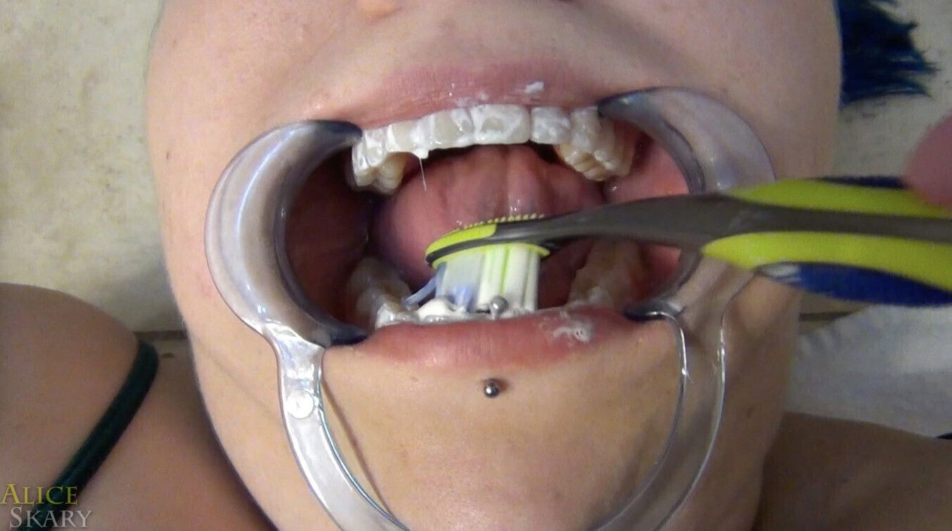 Dentist Probes Naughty Girl's Mouth
