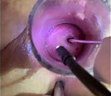 Blissful spasms from estim