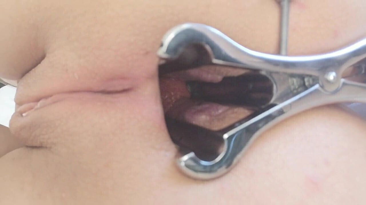 Look inside asshole (anal speculum)