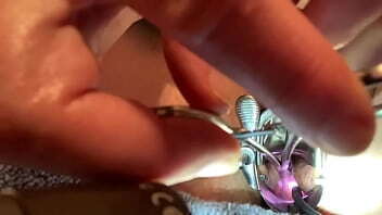 Push/pull ruthless instruments cervix play