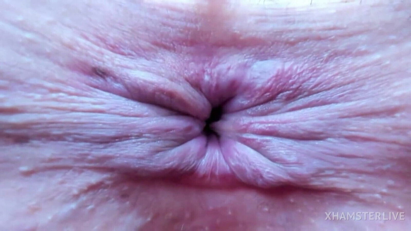 Asshole extreme closeup