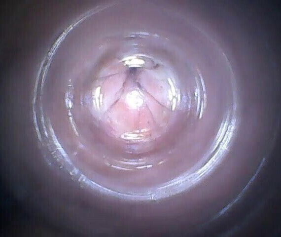 Urethra2. 14mm. poppers