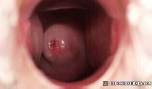 Nurse Zaneta speculum masturbation clinic