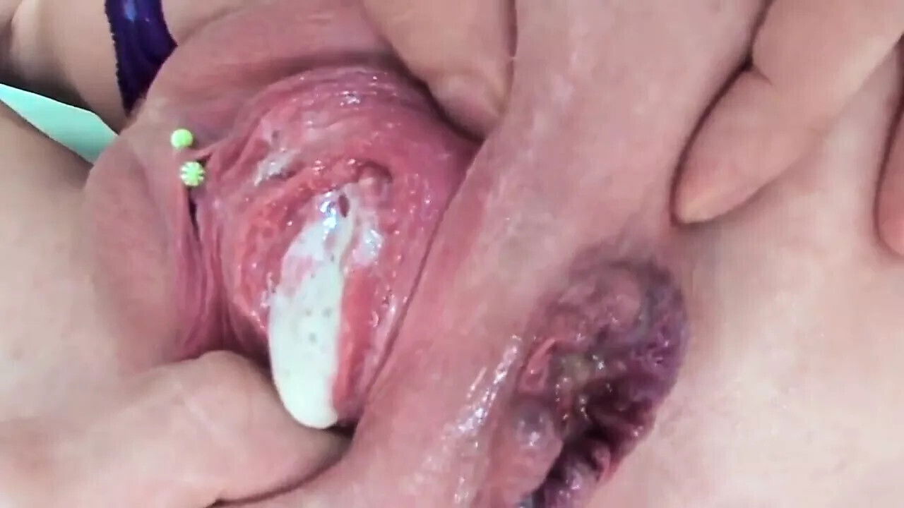NASTY SLUTS COMPILATION GAPED ASSHOLE PROLAPSED