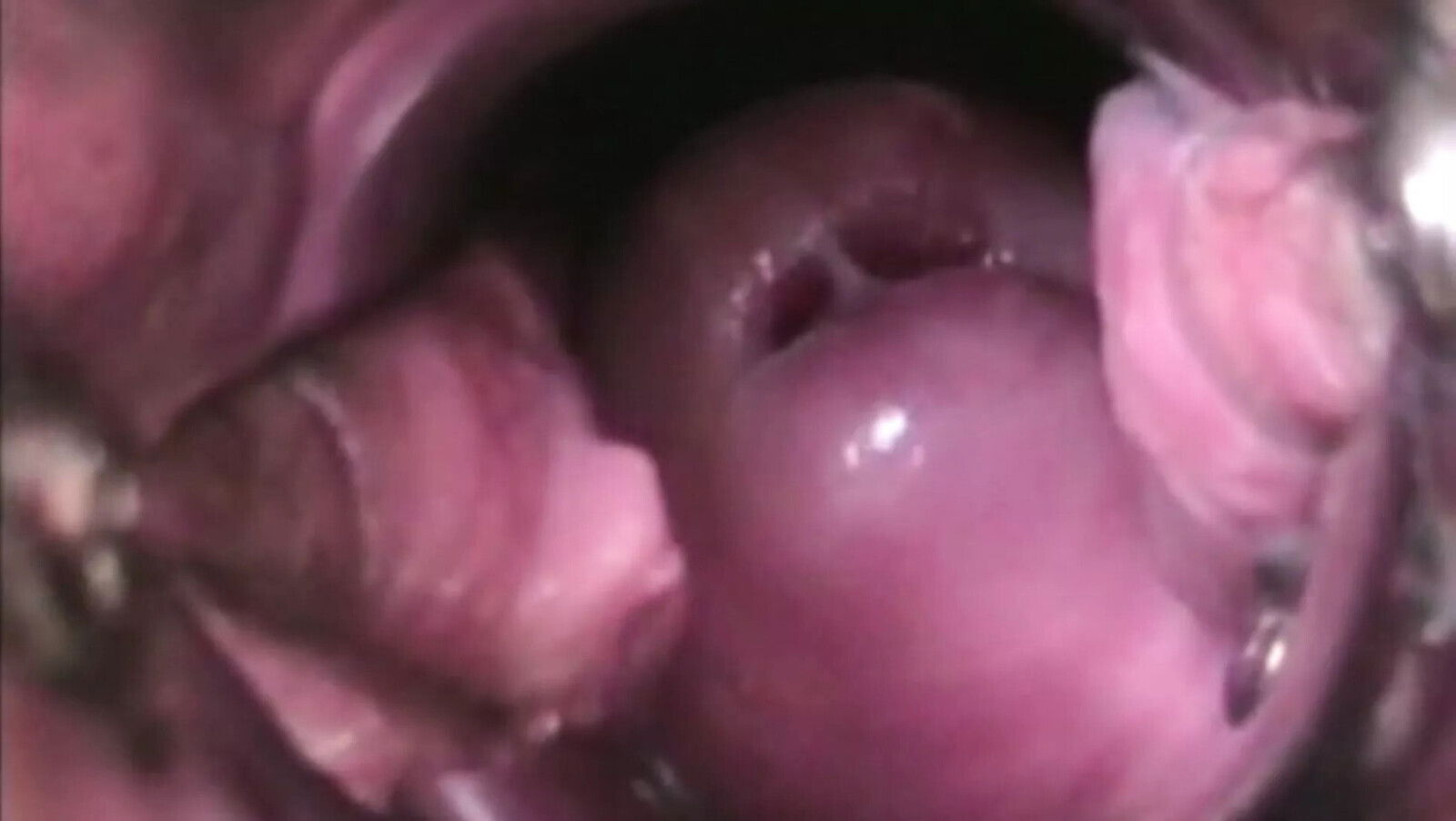 CERVIKAL ORGASM DETAIL