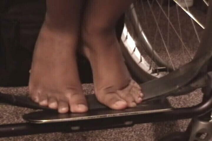 Polio Girl Playing with feet