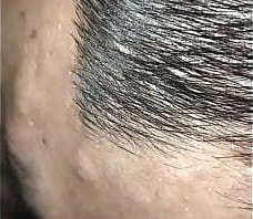 Li&ecirc_́m l&ocirc_̀n vợ y&ecirc_u