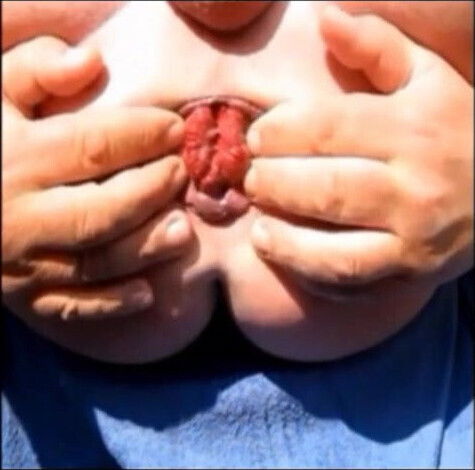 Extrem Monster Asshole Gapinig Gape Hole