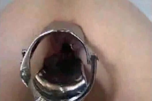 Amateur Extreme Anal Sex