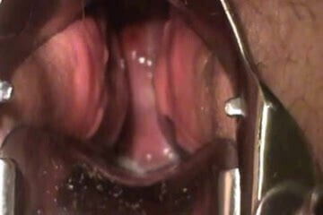 masturbate with speculum show cervix contracting orgasm