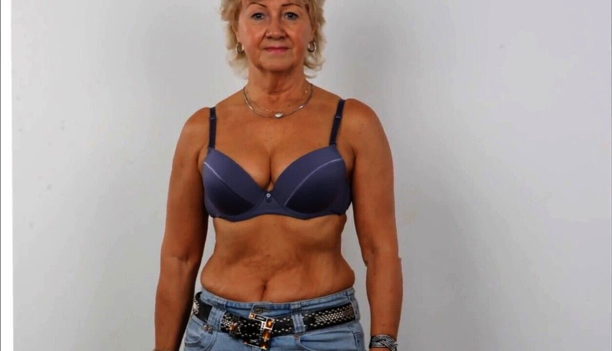 vision, yongs, rayos