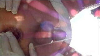 Extreme Anus Dilation Prolapse