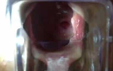 look inside her pussy trough speculum