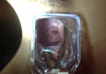 check out her cervix with speculum