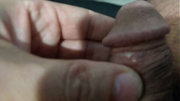 TANTO MINHA MULHER BELISCAR PINTINHO ACABEI FICANDO BOLHAS NELE