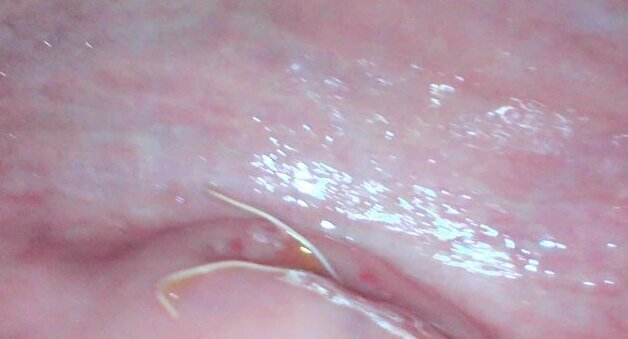 Gaping cunt cervix show