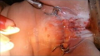 Selbstbestrafung - self-punishment - Autopunition 